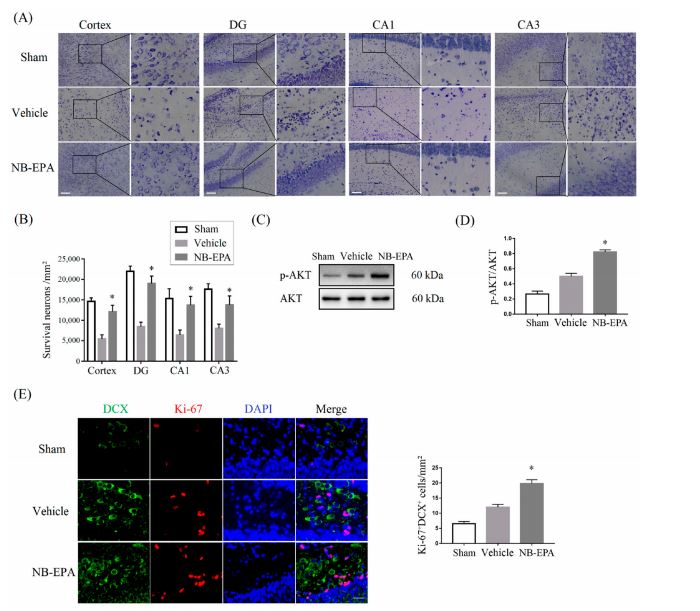 NB-EPA improves the neuronal survival and proliferation in neonatal mice after HI brain injury
