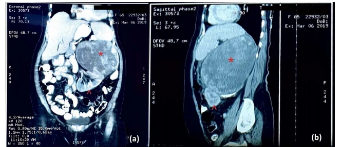 CISTANCHE EXTRACT WITH 25% ECHINACOSIDE AND 9% ACTEOSIDE FOR KIDNEY CISTANCHE EXTRACT WITH 25% ECHINACOSIDE AND 9% ACTEOSIDE FOR KIDNEY
